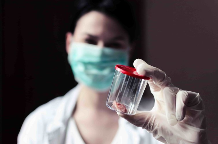 Biopsia Core de Mama en Perú Biopsia Core de Mama en Perú