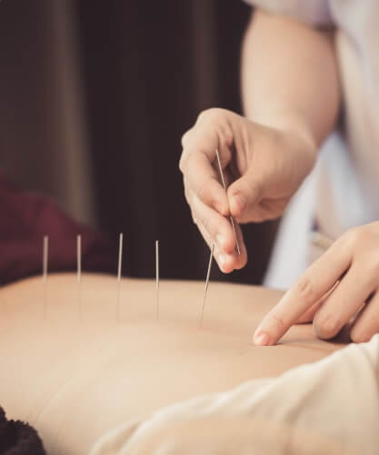 Acupuntura para el cáncer Acupuntura para el cáncer
