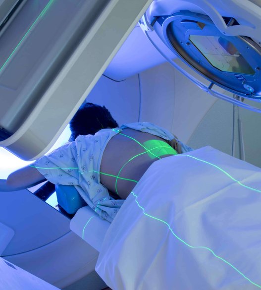 Radioterapia Externa Oncosalud Radioterapia Externa Oncosalud