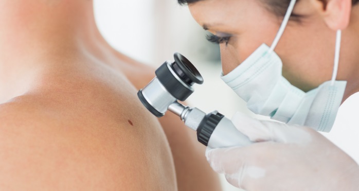 Cáncer de piel Cáncer de piel